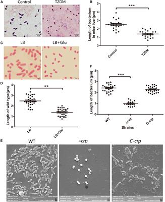 Cyclic AMP-CRP Modulates the Cell Morphology of Klebsiella pneumoniae in High-Glucose Environment